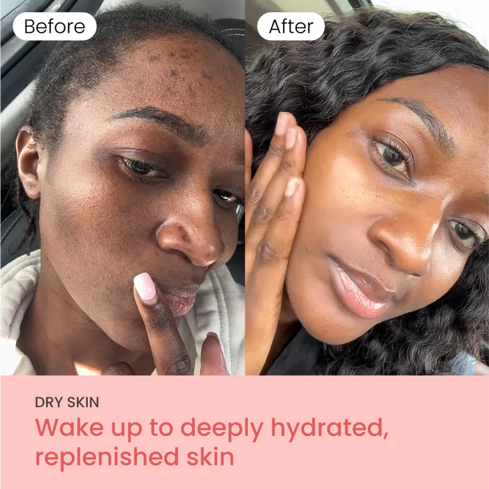 PurSkin™ - Masque de Nuit Hydratant & Anti-Imperfections