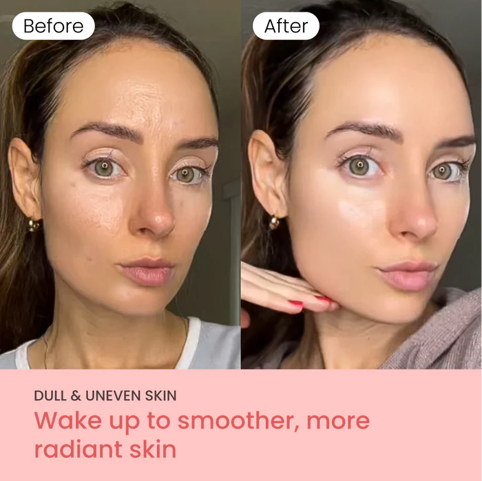 PurSkin™ - Masque de Nuit Hydratant & Anti-Imperfections