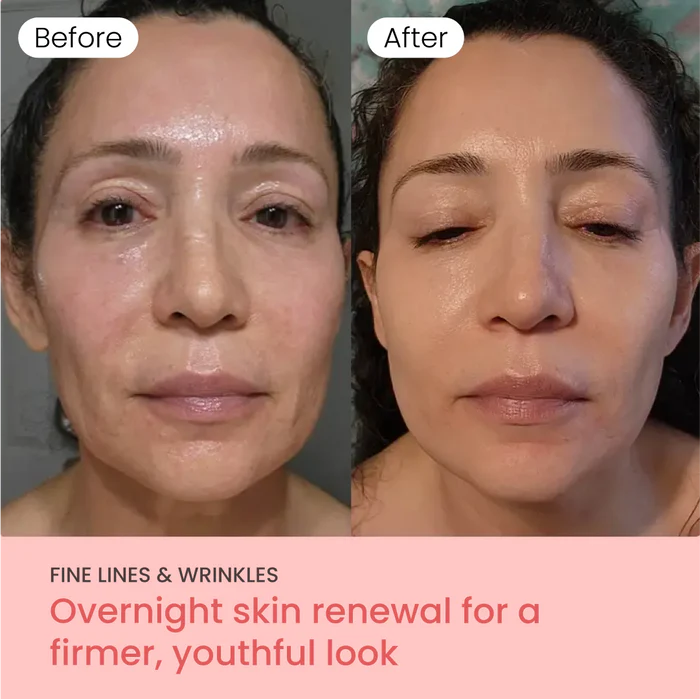 PurSkin™ - Masque de Nuit Hydratant & Anti-Imperfections